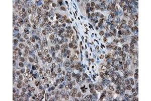 Immunohistochemical staining of paraffin-embedded colon tissue using anti-DAPK2 mouse monoclonal antibody. (DAPK2 Antikörper)