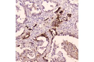 IHC analysis of Cathepsin E using anti-Cathepsin E antibody (ABIN5692831). (Cathepsin E Antikörper  (AA 150-393))