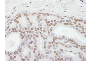 anti-Achaete-Scute Complex Homolog 2 (ASCL2) (AA 50-100) antibody