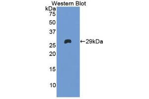 Western blot analysis of the recombinant protein. (Factor XI Antikörper  (AA 170-398))