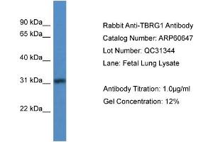 WB Suggested Anti-TBRG1  Antibody Titration: 0. (TBRG1 Antikörper  (N-Term))