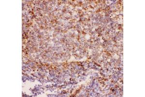 Anti-CD11b Picoband antibody ,  IHC(P): Rat Spleen Tissue (CD11b Antikörper  (AA 17-382))
