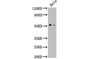 Western Blot Positive WB detected in: Hela whole cell lysate All lanes: NR0B1 antibody at 2. (PPP1R9A Antikörper  (AA 1-243))