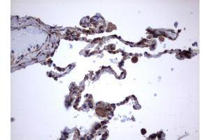 Image no. 2 for anti-Tumor Necrosis Factor Receptor Superfamily, Member 8 (TNFRSF8) (AA 19-379) antibody (ABIN1491086)