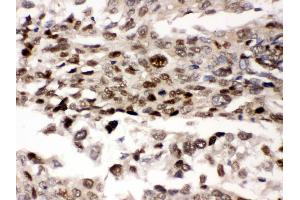 Immunohistochemistry (IHC) image for anti-Protein Kinase, AMP-Activated, beta 2 Non-Catalytic Subunit (PRKAB2) (AA 56-89), (N-Term) antibody (ABIN3043907)