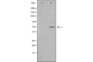 Western blot analysis of A549 whole cell lysates, using TYMP  Antibody.