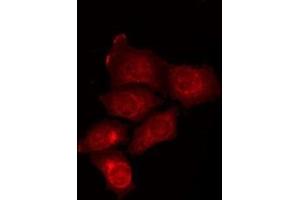 ABIN6275881 staining HepG2 by IF/ICC. (ATG16L2 Antikörper  (Internal Region))