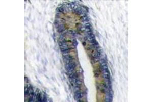 Image no. 2 for anti-Finkel-Biskis-Reilly Murine Sarcoma Virus (FBR-MuSV) Ubiquitously Expressed (FAU) (Center) antibody (ABIN357137)