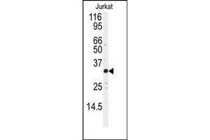 Western blot analysis of anti-JUND Antibody in Jurkat cell line lysates (35ug/lane).