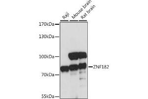Western blot analysis of extracts of various cell lines, using ZNF182 antibody (ABIN7271462) at 1:1000 dilution. (ZNF182 Antikörper  (AA 100-210))