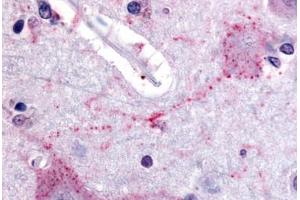 Human Brain, Cortex (formalin-fixed, paraffin-embedded) stained with PCSK6 antibody ABIN213558 at 20 ug/ml followed by biotinylated goat anti-rabbit IgG secondary antibody ABIN481713, alkaline phosphatase-streptavidin and chromogen. (PCSK6 Antikörper  (Internal Region))