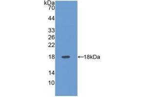 Detection of Recombinant SELE, Human using Polyclonal Antibody to E-selectin (Selectin E/CD62e Antikörper  (AA 108-238))