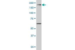 Western Blotting (WB) image for anti-Mitogen-Activated Protein Kinase Kinase Kinase 4 (MAP3K4) (AA 1201-1300) antibody (ABIN598811) (MAP3K4 Antikörper  (AA 1201-1300))