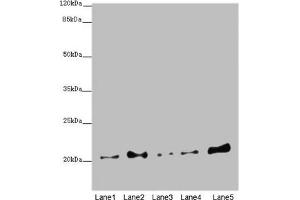 Western blot All lanes: COMMD1 antibody at 5. (COMMD1 Antikörper  (AA 1-190))