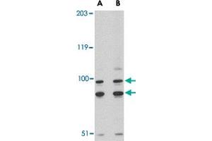 Western blot analysis of SATB1 in A-20 cell lysate with SATB1 polyclonal antibody  at (A) 2 and (B) 4 ug/mL . (SATB1 Antikörper  (C-Term))