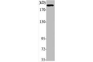 Western Blot analysis of various cells using Phospho-IRS-1 (S794) Polyclonal Antibody (IRS1 Antikörper  (pSer794))