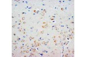 Immunohistochemical analysis of paraffin embedded rat tissue sections (brain), staining SHH in cytoplasm, DAB chromogenic reaction