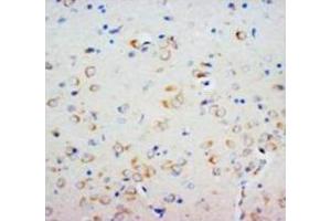 Immunohistochemical analysis of paraffin embedded rat tissue sections (brain), staining SHH in cytoplasm, DAB chromogenic reaction (Sonic Hedgehog Antikörper  (N-Term))