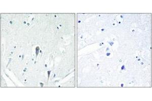 Immunohistochemistry (IHC) image for anti-Interleukin-1 Receptor-Associated Kinase 3 (IRAK3) (AA 491-540) antibody (ABIN2889831) (IRAK3 Antikörper  (AA 491-540))