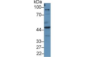 Western blot analysis of Human A549 cell lysate, using Human PRAME Antibody (2 µg/ml) and HRP-conjugated Goat Anti-Rabbit antibody ( (PRAME Antikörper  (AA 416-502))