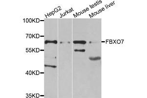 Western blot analysis of extracts of various cell lines, using FBXO7 antibody (ABIN5975552) at 1/1000 dilution. (FBXO7 Antikörper)