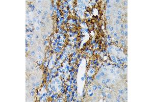 Immunohistochemistry of paraffin-embedded human liver using Collagen VI/COL6 Rabbit mAb (ABIN7266462) at dilution of 1:100 (40x lens). (COL6A1 Antikörper)