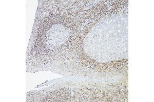 Immunohistochemistry of paraffin-embedded Human tonsil(100X) using Bcl-2 antibody (ABIN7265810) at dilution of 1:100 (40x lens). (Bcl-2 Antikörper)