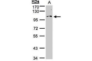 WB Image Sample (30μg whole cell lysate) A:Hep G2 , 7. (NCKAP1 Antikörper)