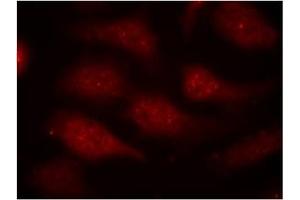 Image no. 1 for anti-Cyclin-Dependent Kinase 6 (CDK6) (pTyr24) antibody (ABIN319290) (CDK6 Antikörper  (pTyr24))