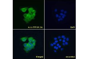 ABIN6391349 Immunofluorescence analysis of paraformaldehyde fixed A431 cells, permeabilized with 0.