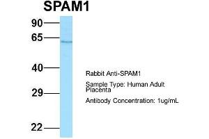 Host: Rabbit Target Name: SPAM1 Sample Type: Human Adult Placenta Antibody Dilution: 1.