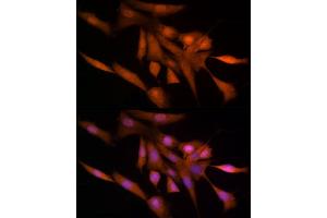Immunofluorescence analysis of NIH/3T3 cells using Ube2L3 / UBCH7 Rabbit mAb (ABIN7271178) at dilution of 1:25 (40x lens). (UBE2L3 Antikörper)