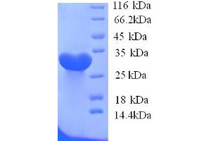 SDS-PAGE (SDS) image for Potassium Inwardly-Rectifying Channel, Subfamily J, Member 1 (KCNJ1) (AA 178-391), (Cytoplasmic Domain), (Cytosolic) protein (His tag) (ABIN4975460) (KCNJ1 Protein (AA 178-391, Cytoplasmic Domain, Cytosolic) (His tag))