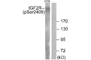 Immunohistochemistry analysis of paraffin-embedded human brain tissue using IGF2R (Phospho-Ser2409) antibody. (IGF2R Antikörper  (pSer2409))