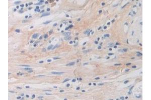 Immunohistochemistry (IHC) image for anti-Periostin (POSTN) (AA 97-230) antibody (ABIN7436453)