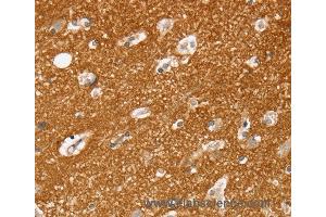 Immunohistochemistry of Human brain  using SLC25A13 Polyclonal Antibody at dilution of 1:35