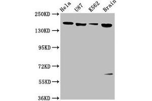 Western Blot Positive WB detected in: Hela whole cell lysate, U87 whole cell lysate, K562 whole cell lysate, Rat brain tissue All lanes: LIFR antibody at 3. (LIFR Antikörper  (AA 915-1086))