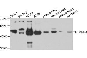 Western blot analysis of extracts of various cell lines, using STARD3 antibody. (STARD3 Antikörper)