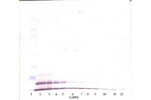 Image no. 3 for anti-Growth Regulated Oncogene gamma (GRO gamma) antibody (ABIN465909) (GRO gamma Antikörper)