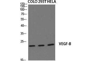 Western Blot (WB) analysis of specific cells using VEGF-B Polyclonal Antibody.