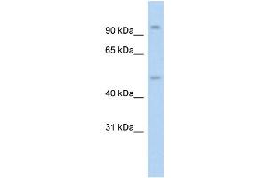 WB Suggested Anti-NR3C1 Antibody Titration: 1. (Glucocorticoid Receptor Antikörper  (N-Term))