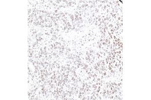 Immunohistochemistry (IHC) image for anti-Interferon, gamma-Inducible Protein 16 (IFI16) (AA 350-400) antibody (ABIN7795821)
