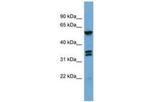 Image no. 1 for anti-G Protein-Coupled Receptor Kinase 4 (GRK4) (AA 359-408) antibody (ABIN6745674) (GRK4 Antikörper  (AA 359-408))