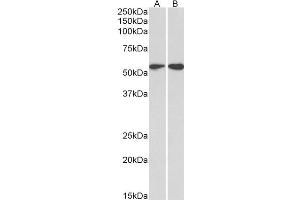 ABIN2613493 (2µg/ml) staining of HeLa (A) and Jurkat (B) lysates (35µg protein in RIPA buffer). (Vimentin Antikörper  (C-Term))