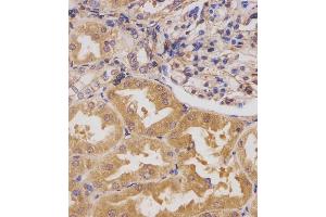 (ABIN391779 and ABIN2841638) staining HIPK3 in human kidney tissue sections by Immunohistochemistry (IHC-P - paraformaldehyde-fixed, paraffin-embedded sections). (HIPK3 Antikörper  (C-Term))