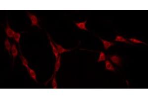 ABIN6275163 staining Hela by IF/ICC. (GIDRP88 Antikörper  (C-Term))