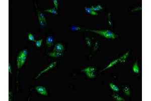 Immunofluorescent analysis of Hela cells using ABIN7144950 at dilution of 1:100 and Alexa Fluor 488-congugated AffiniPure Goat Anti-Rabbit IgG(H+L) (PFKL Antikörper  (AA 229-479))