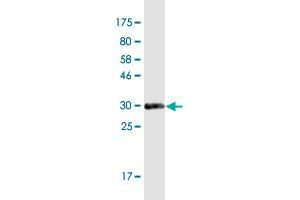 Western Blot detection against Immunogen (33. (RNF170 Antikörper  (AA 121-193))