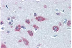 Human Brain, Cortex: Formalin-Fixed, Paraffin-Embedded (FFPE) (FARSB Antikörper  (AA 234-342))