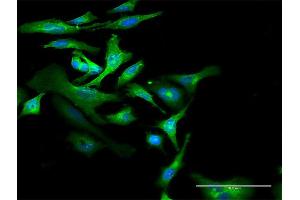 Immunofluorescence of purified MaxPab antibody to CD59 on HeLa cell. (CD59 Antikörper  (AA 1-128))